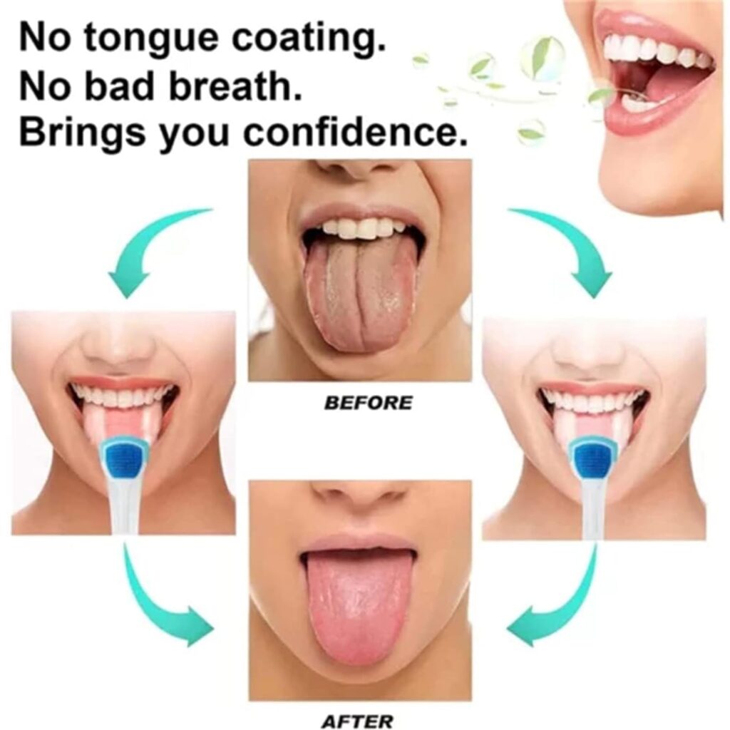 tongue1-2.jpg